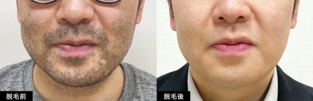 リンクスの症例写真