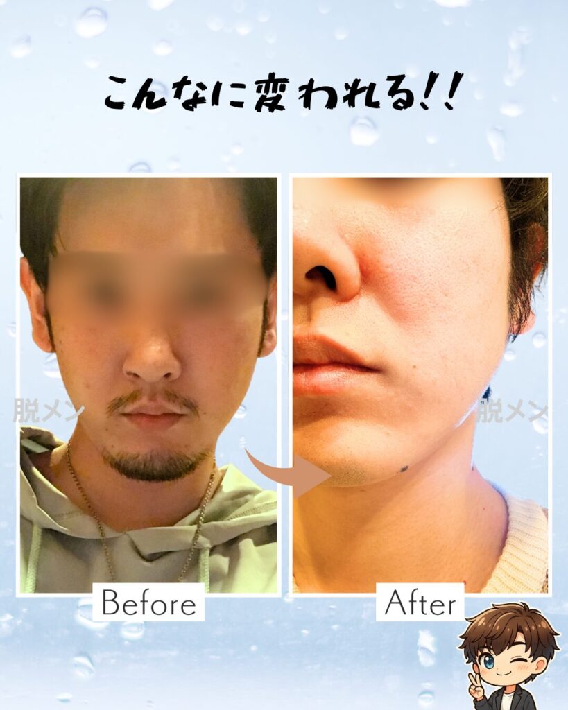 メンズクリアに2年通った実際の写真。
ビフォーアフター